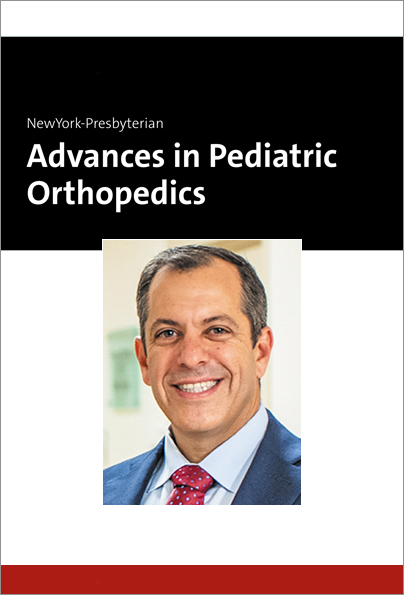 Advances in Pediatric Orthopedics: Thoracic Tether vs Fusion