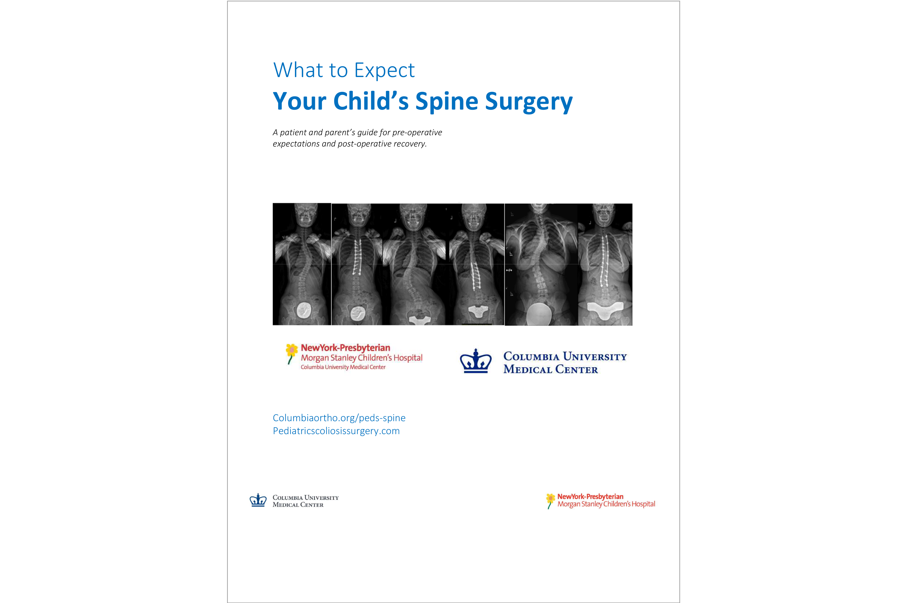 Spine-Surgery-What-To-Expect-5-27-25-Cover